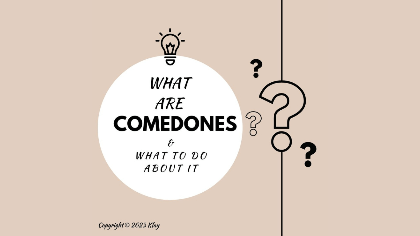 Comedones And What To Do About It?