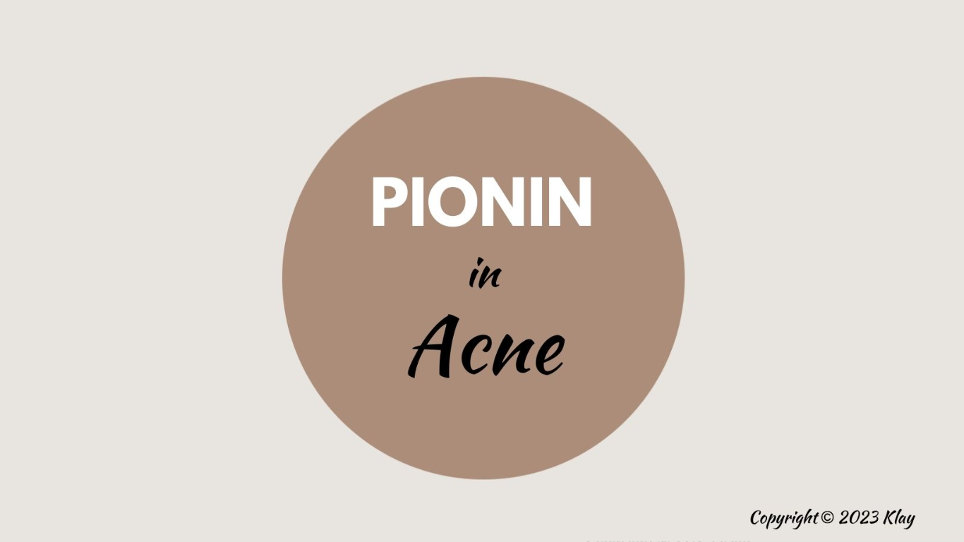 Holistic Way Of Preventing Acne Breakout And Acne Marks