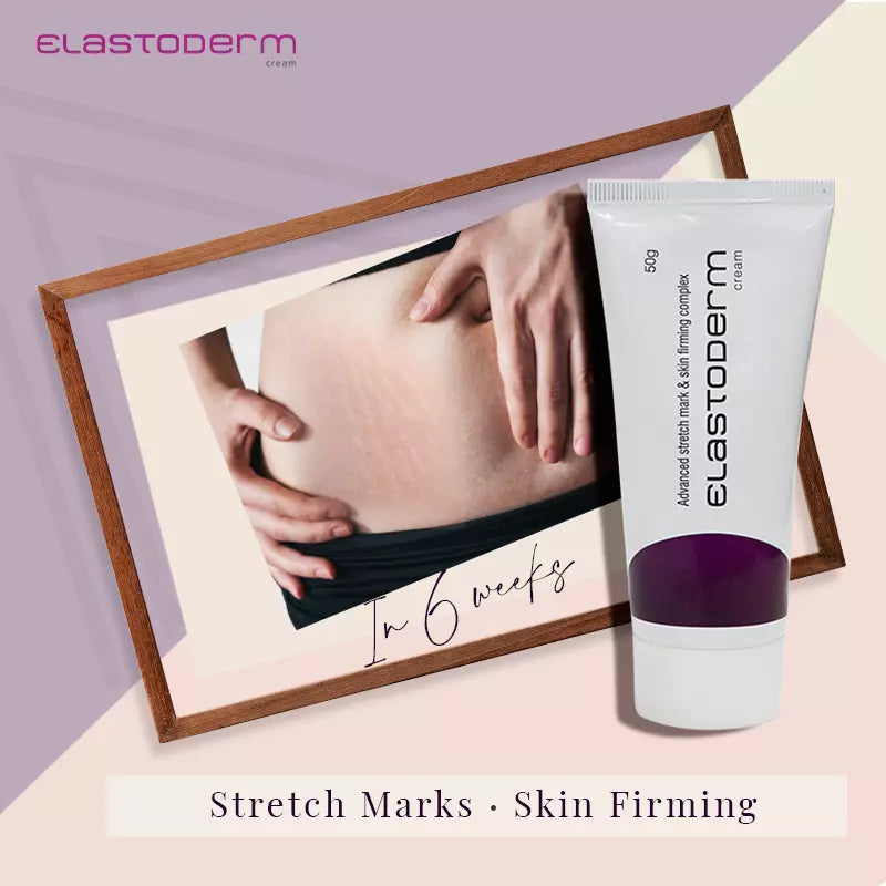 Elastoderm Stretch Marks cream