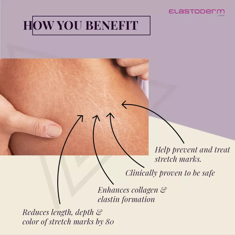 benefits of Elastoderm Stretch Marks cream