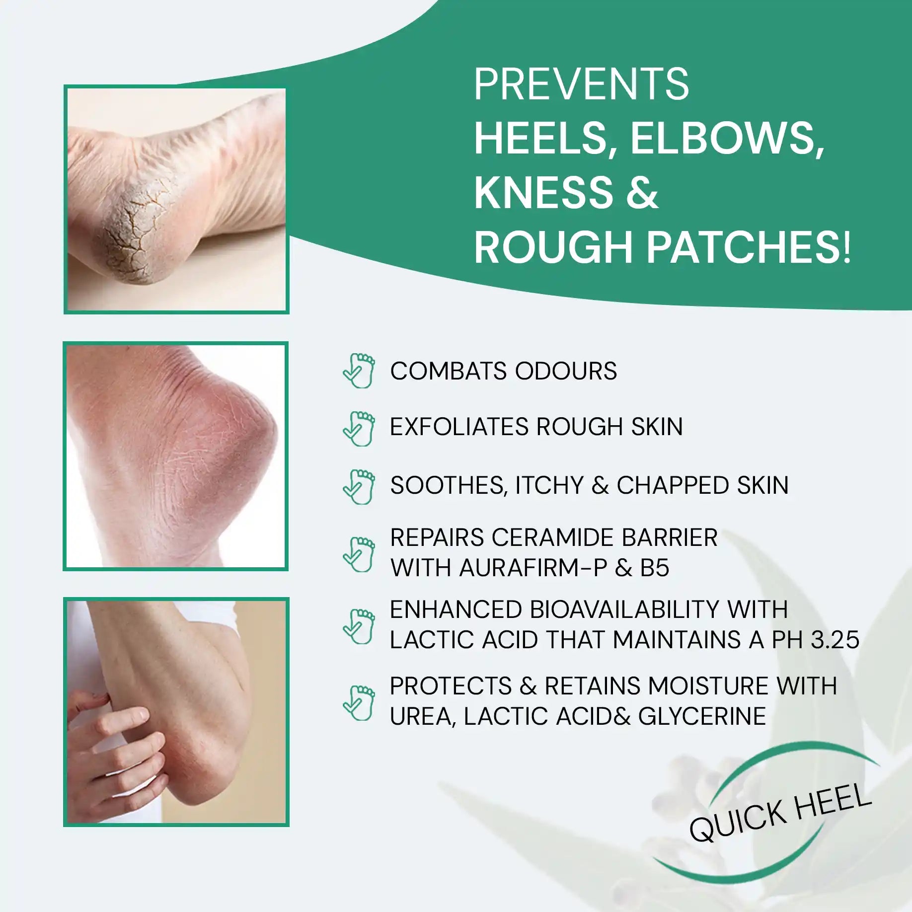prevent rough heels with Irwings Foot Care Cream