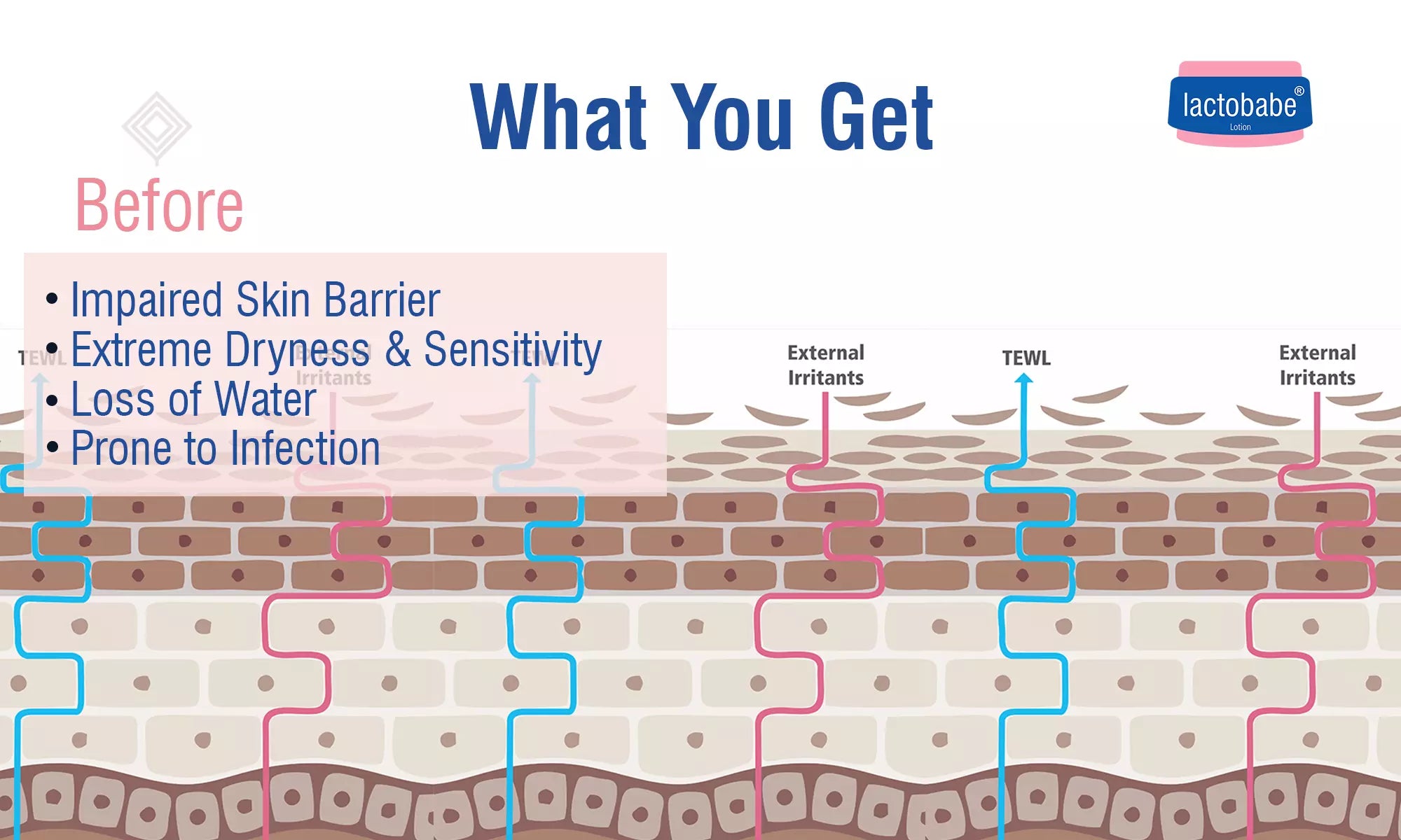 working of lactobabe lotion for dry skin