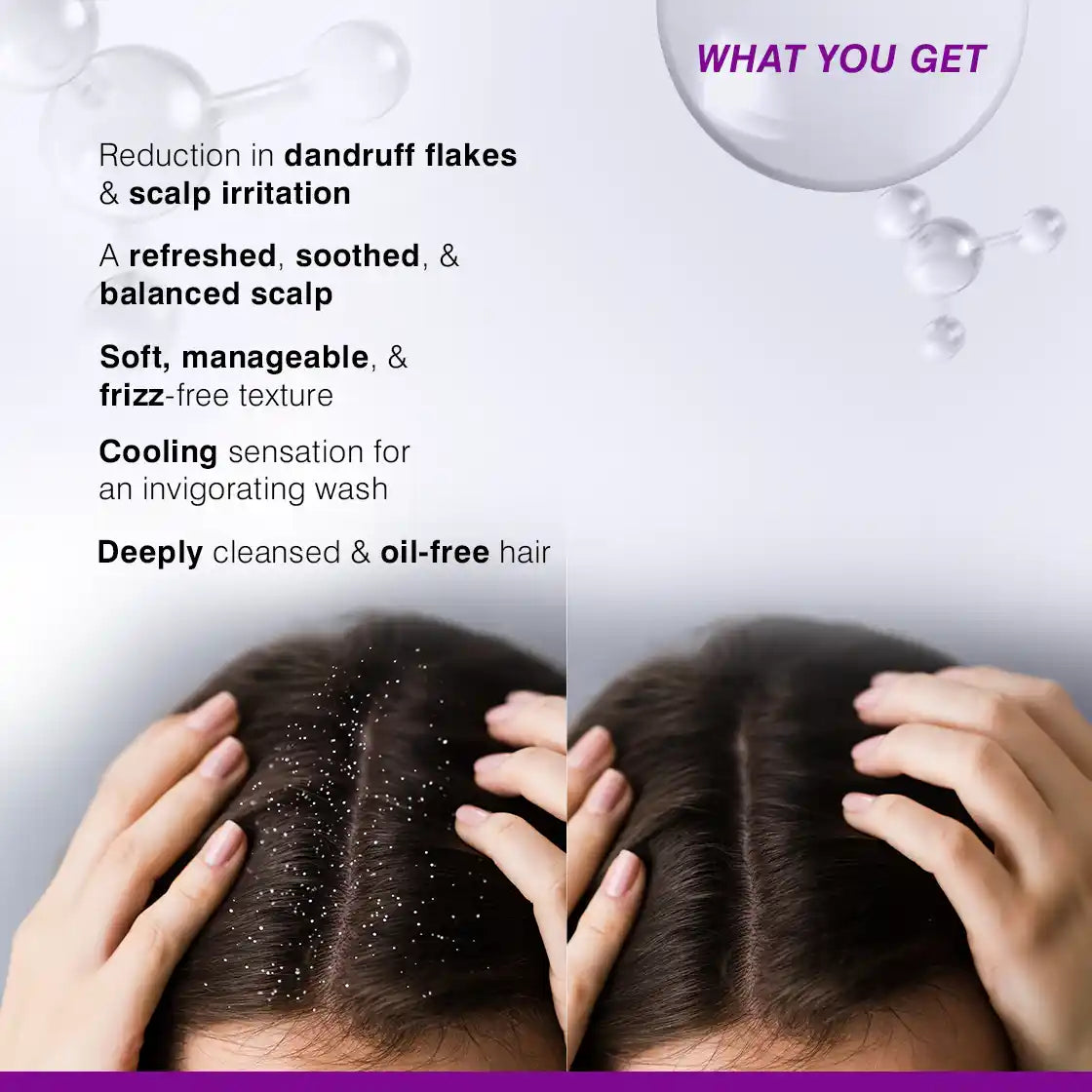 what you get in Trigaine pro Ant Dandruff Shampoo