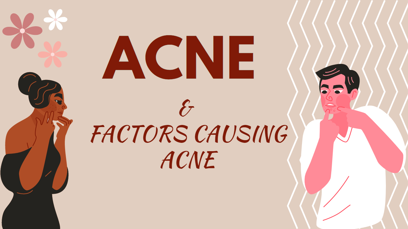 Acne & Factors Causing Acne