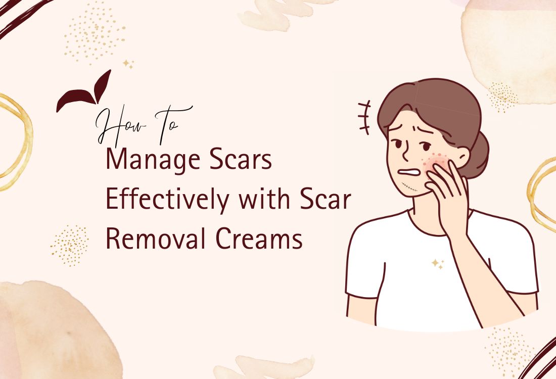 How to Manage Scars Effectively with Scar Removal Creams