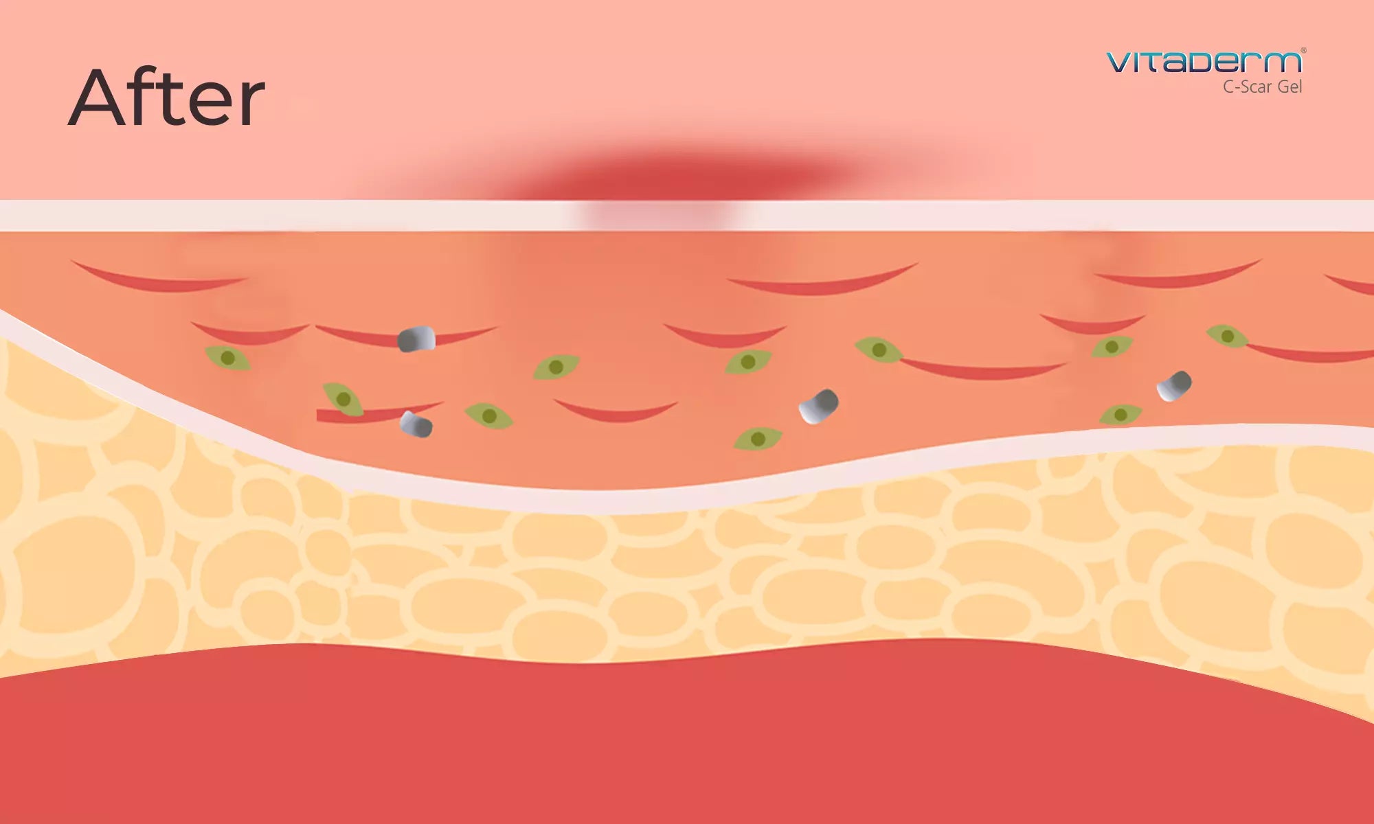 how vitaderm c scar gel works on scars and marks