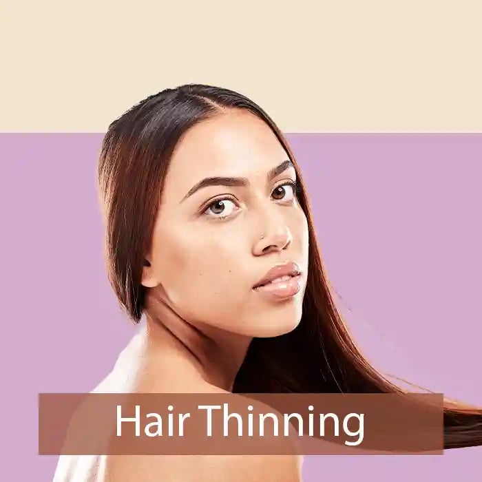 Hair_thinning
